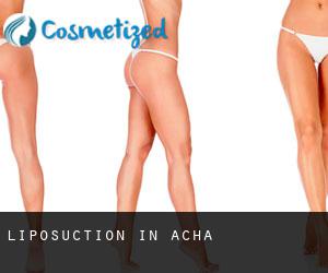 Liposuction in Acha