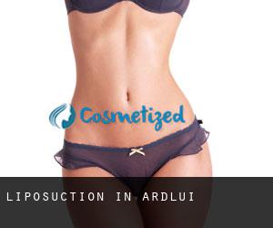 Liposuction in Ardlui