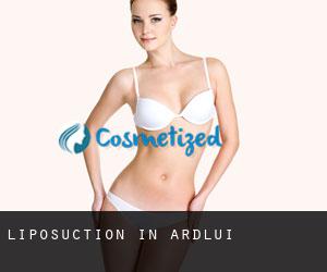 Liposuction in Ardlui