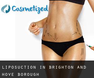 Liposuction in Brighton and Hove (Borough)