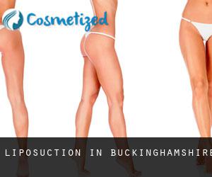 Liposuction in Buckinghamshire