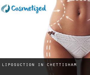 Liposuction in Chettisham