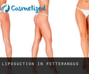 Liposuction in Fetterangus