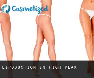 Liposuction in High Peak