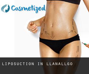 Liposuction in Llanallgo