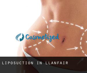 Liposuction in Llanfair