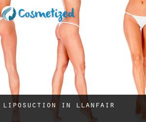 Liposuction in Llanfair