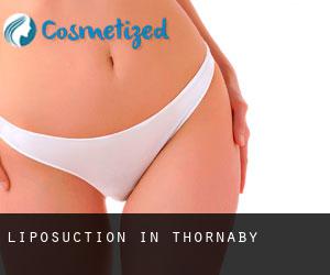Liposuction in Thornaby
