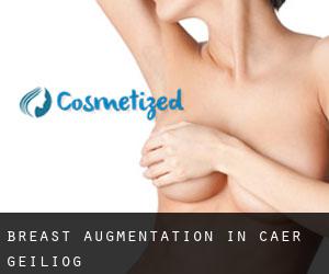 Breast Augmentation in Cae'r-geiliog