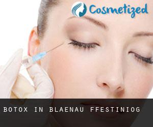 Botox in Blaenau-Ffestiniog Botox in Blaenau-Ffestiniog