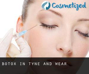 Botox in Tyne and Wear Botox in Tyne and Wear