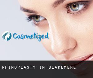 Rhinoplasty in Blakemere