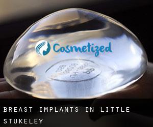 Breast Implants in Little Stukeley