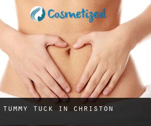 Tummy Tuck in Christon