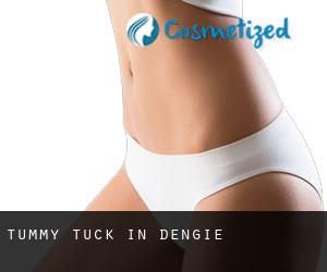 Tummy Tuck in Dengie