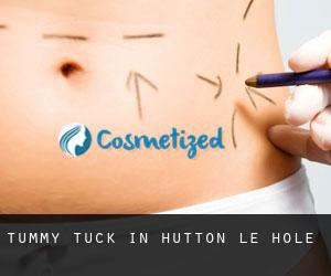 Tummy Tuck in Hutton le Hole