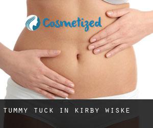 Tummy Tuck in Kirby Wiske