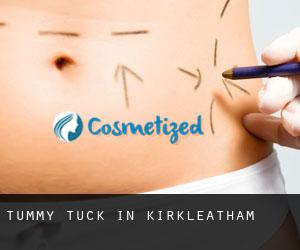 Tummy Tuck in Kirkleatham
