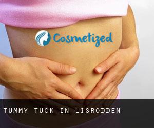 Tummy Tuck in Lisrodden