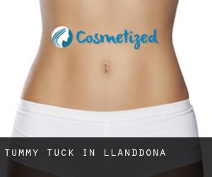 Tummy Tuck in Llanddona