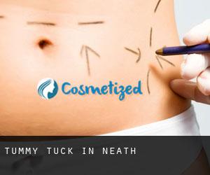 Tummy Tuck in Neath