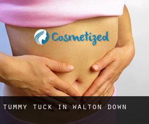 Tummy Tuck in Walton Down